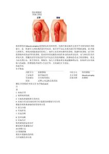 肌肉萎缩症