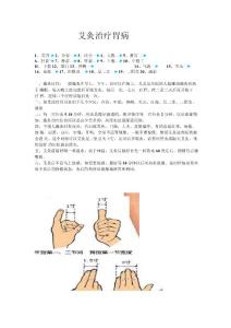 艾灸治疗胃病