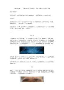 白癜风治好了，白癜风治疗康复案例，眉部白癜风治疗康复案例（外部）