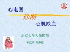 心电图诊断心肌缺血