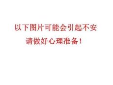 密集物体恐惧症