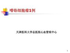 嗜铬细胞瘤1例