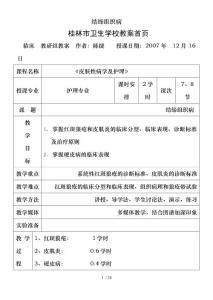 结缔组织病