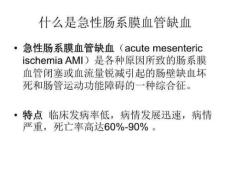 急性肠系膜血管缺血性疾病的诊断