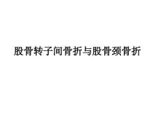 股骨转子间骨折与股骨颈骨折