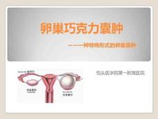 介入治疗卵巢囊肿