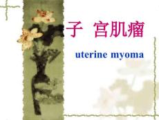 子宫肌瘤课件