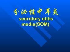 分泌性中耳炎 急性化脓性中耳炎