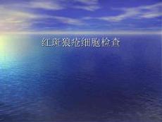 红斑狼疮细胞检查