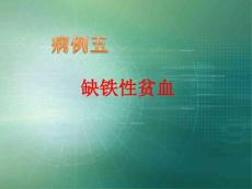 缺铁性贫血ppt