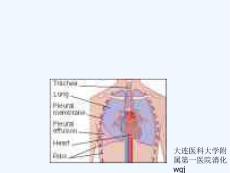 胸腔积液课件