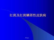 红斑及红斑鳞性皮肤病红斑