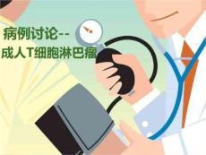 成人T细胞淋巴瘤医学PPT