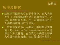 结核性脑膜炎治疗