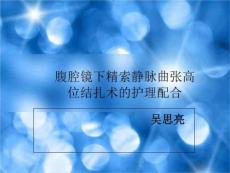 精索静脉曲张高位结扎