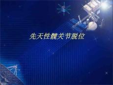 先天性髋关节脱位