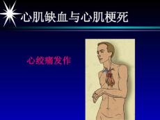 心肌缺血心肌梗死