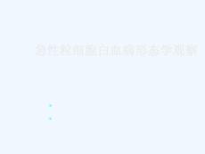 急性粒细胞白血病形态学观察