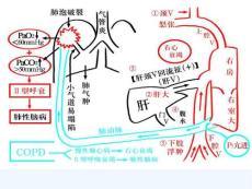 慢性心衰治疗概要
