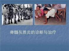 脊髓灰质炎医学PPT