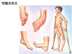 脊髓脑干小脑间脑PPT