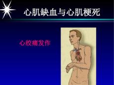心肌缺血心肌梗死
