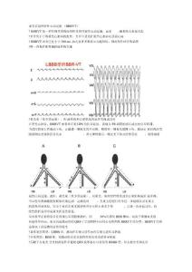 束支折返性室性心动过速