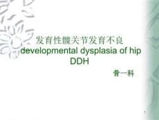 发育性髋关节发育不良