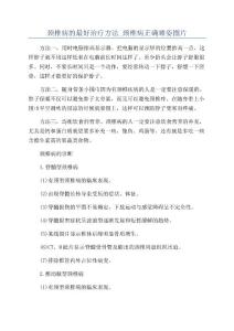 颈椎病的最好治疗方法_颈椎病正确睡姿图片