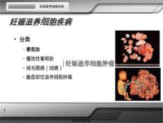 妊娠滋养细胞疾病