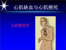 心肌缺血、心肌梗死