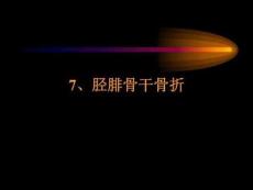 胫腓骨干骨折课件