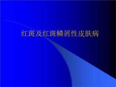 红斑及红斑鳞性皮肤病红斑