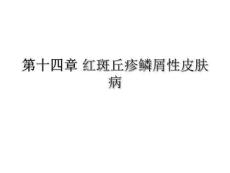 《红斑鳞屑性病》PPT课件