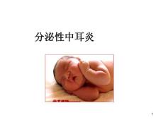 分泌性中耳炎-课件