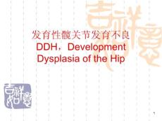 发育性髋关节发育不良ddh课件