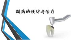 《龋齿的治疗》