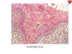 单纯性淋巴结炎