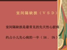 室间隔缺损VSD