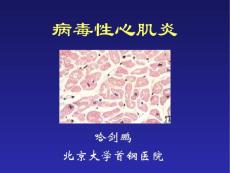 小儿病毒性心肌炎