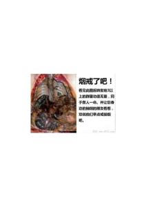 吸烟者的内脏