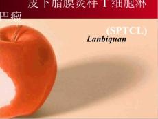皮下脂膜炎样T细胞淋巴瘤