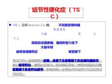 结节性硬化症