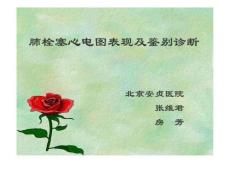 肺栓塞心电图
