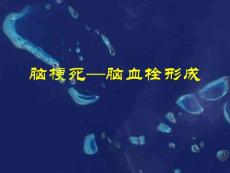 脑梗死—脑血栓