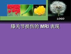 膝关节损伤MRI诊断