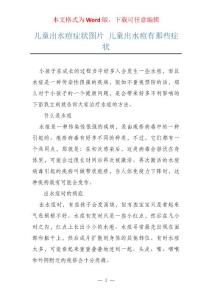 儿童出水痘症状图片 儿童出水痘有那些症状