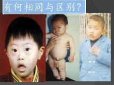 遗传代谢病PPT课件