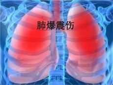 肺爆震伤精选文档课件