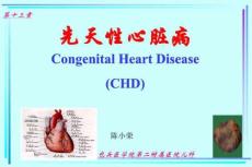 室间隔缺损.ppt